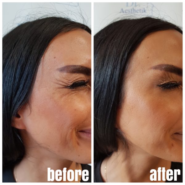 Galerie | Dr. Aesthetik