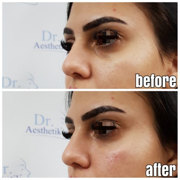 Galerie | Dr. Aesthetik